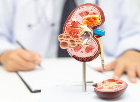 Böbrekleri 'altın' gibi koruyan besinler 