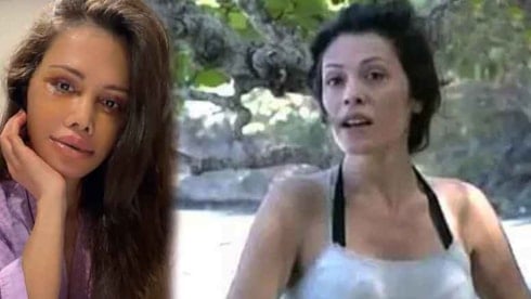 Survivor ünlüsü estetik için Kore'de yüz kemiklerini kestirdi