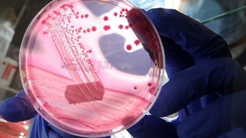 DSÖ'den kanser açıklaması: Dünya genelindeki vakaların 4'te 1'i önlenebilir